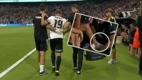 Beşiktaş'ta Trossard sakatlığı: Travmatik kemik ödemi nedir?